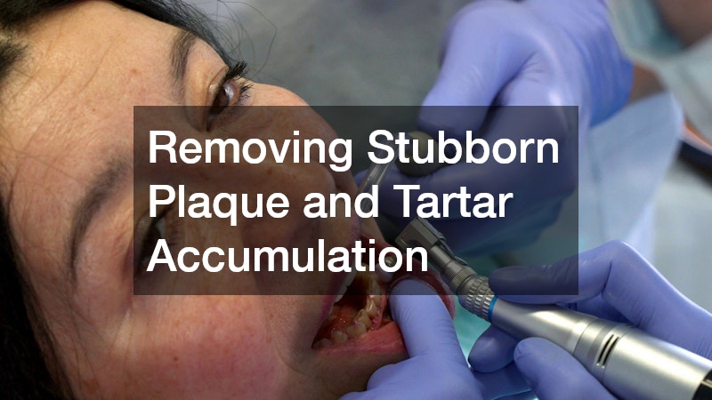 Removing Stubborn Plaque and Tartar Accumulation