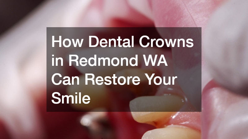 How Dental Crowns in Redmond WA Can Restore Your Smile