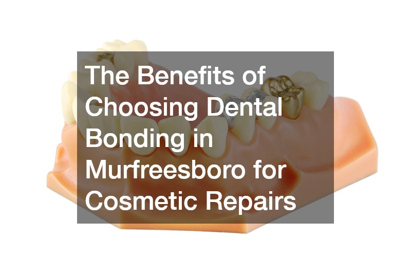 The Benefits of Choosing Dental Bonding in Murfreesboro for Cosmetic Repairs