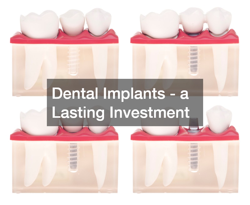 Dental Implants - a Lasting Investment