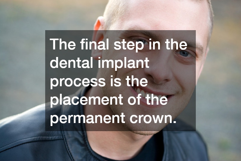 The final step in the dental implant process is the placement of the permanent crown.