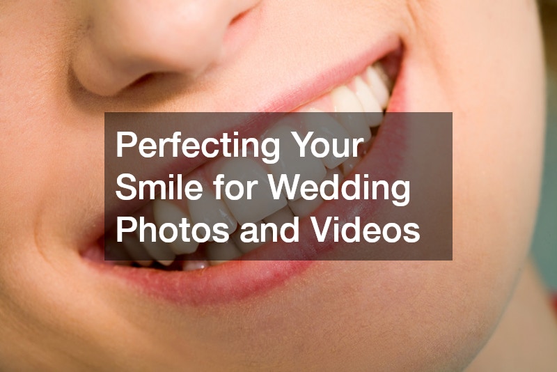 Perfecting Your Smile for Wedding Photos and Videos