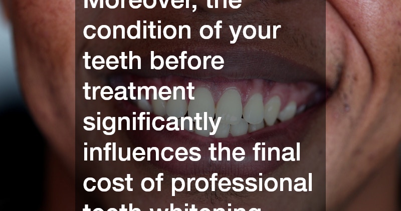 Moreover, the condition of your teeth before treatment significantly influences the final cost of professional teeth whitening