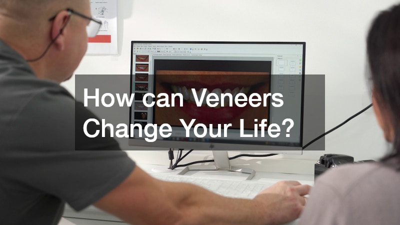 How can Veneers Change Your Life?