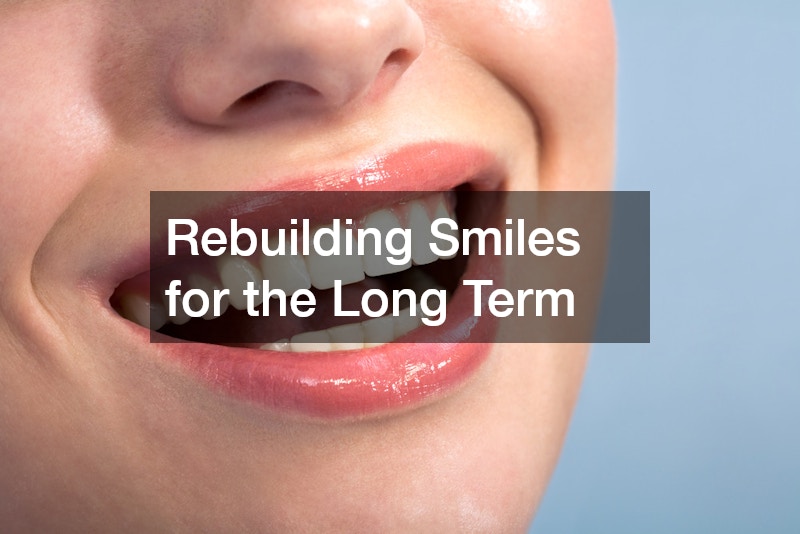 Rebuilding Smiles for the Long Term