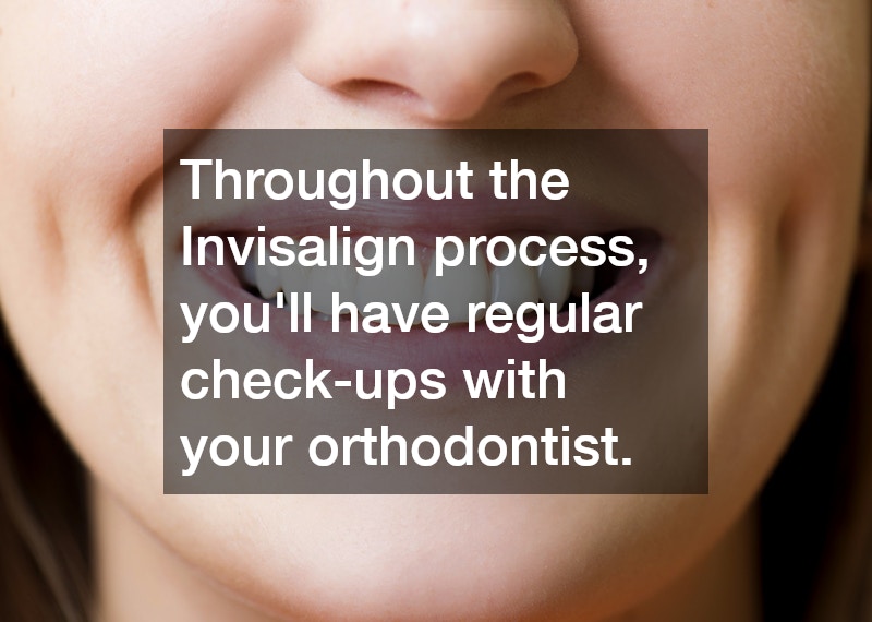 Throughout the Invisalign process, you