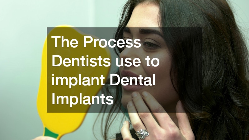The Process Dentists use to implant Dental Implants