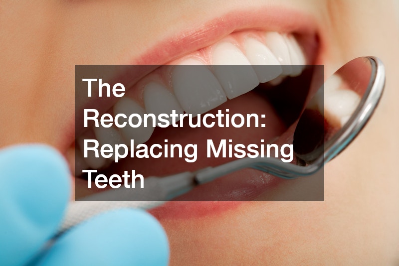 The Reconstruction: Replacing Missing Teeth