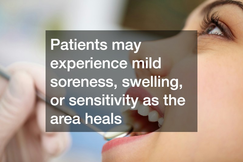 Patients may experience mild soreness, swelling, or sensitivity as the area heals