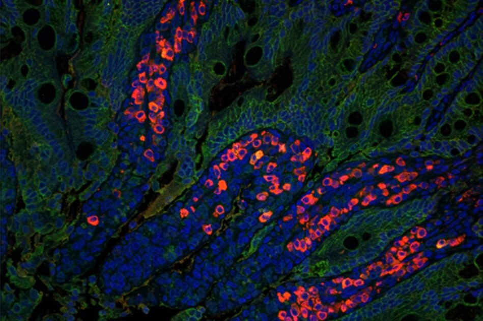A new vaccine adjuvant could make it easier to eradicate polio