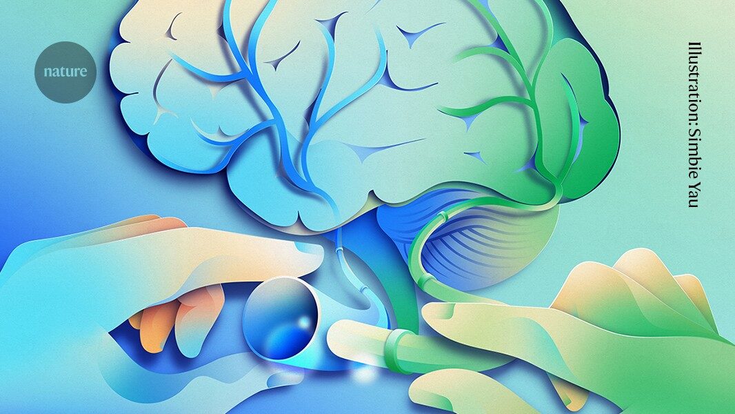 A controversial Alzheimer's surgery is said to reverse symptoms ' here's what scientists know