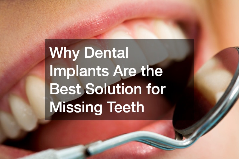 Why Dental Implants Are the Best Solution for Missing Teeth