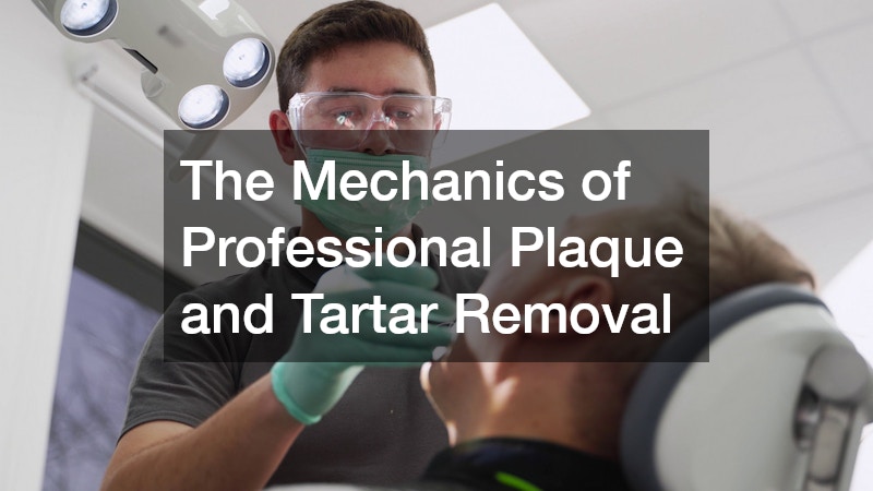 The Mechanics of Professional Plaque and Tartar Removal