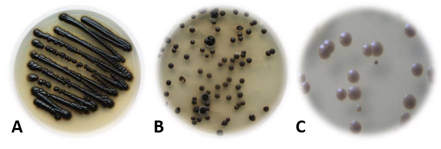 Figure 1: Pure culture (A) of black yeast Exophiala dermatitidis, rarely isolated from natural environments, but frequently isolated from human made environments, such as dishwashers (B), kitchen facilities (C), saunas, … Figure 1: Pure culture (A) of black yeast Exophiala dermatitidis, rarely isolated from natural environments, but frequently isolated from human made environments, such as dishwashers (B), kitchen facilities (C), saunas, …