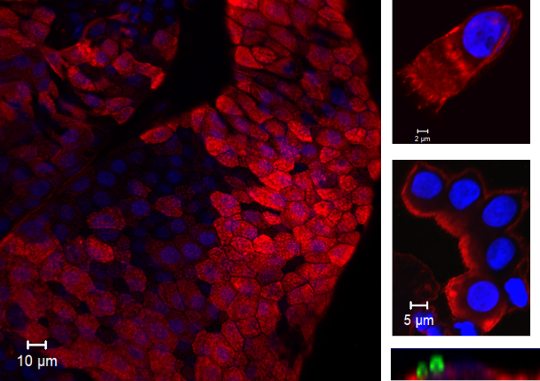 Cells collected from the EHPC biopsies. Cells collected from the EHPC biopsies.