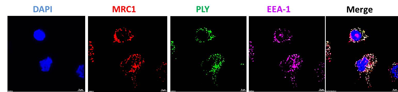 MRC-1 co-localizes with pneumolysin MRC-1 co-localizes with pneumolysin