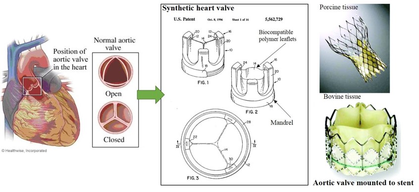 Evolution of aortic valve replacement Evolution of aortic valve replacement