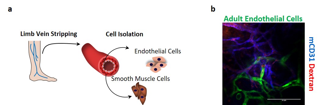 Figure 1. Vasculogenic potential of adult limb vein-isolated vascular cells for cell therapy applications. Figure 1. Vasculogenic potential of adult limb vein-isolated vascular cells for cell therapy applications.