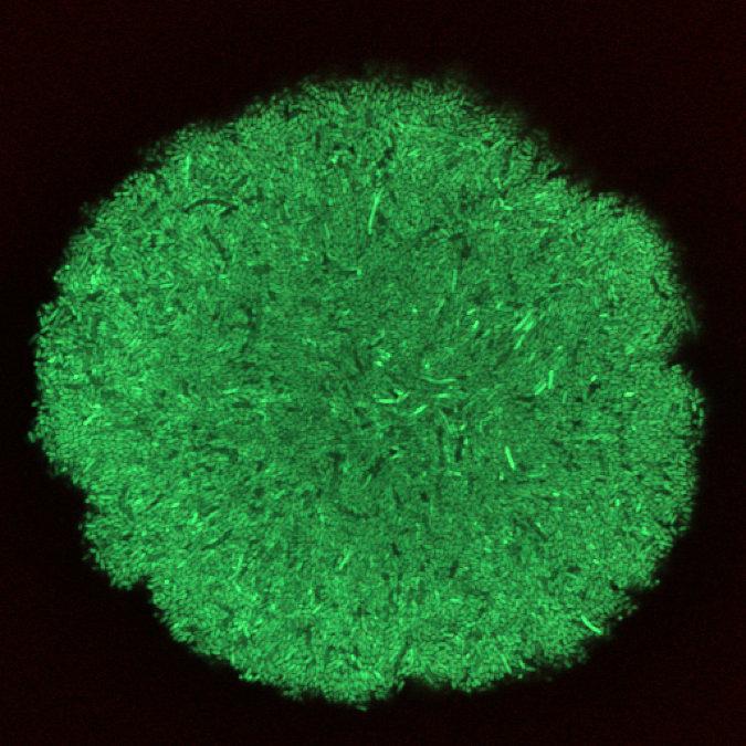 Biofilm in the gel Biofilm in the gel