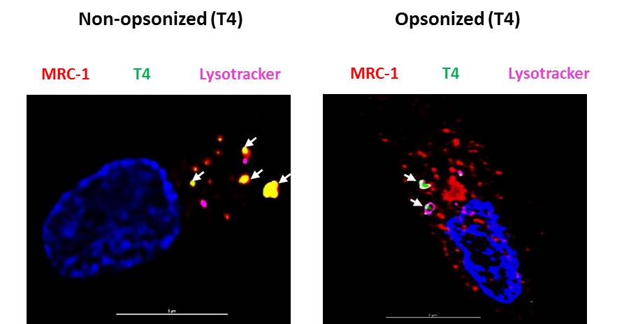 Intracellular co-localization of pneumococci with MRC1 Intracellular co-localization of pneumococci with MRC1
