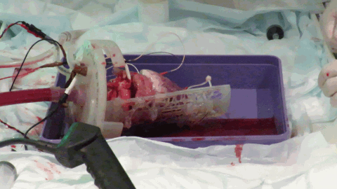 The beating Langendorff perfused pig heart The beating Langendorff perfused pig heart