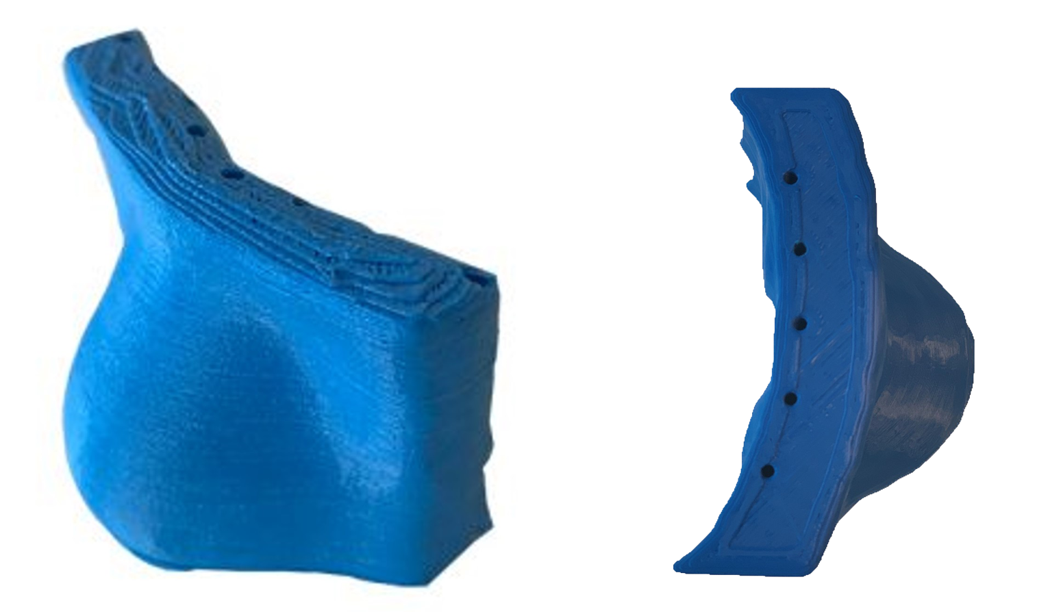 3D printed HDR surface brachytherapy applicators 3D printed HDR surface brachytherapy applicators