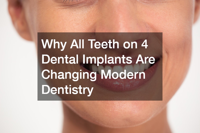 Why All Teeth on 4 Dental Implants Are Changing Modern Dentistry