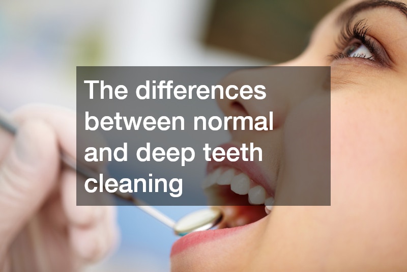 The differences between normal and deep teeth cleaning