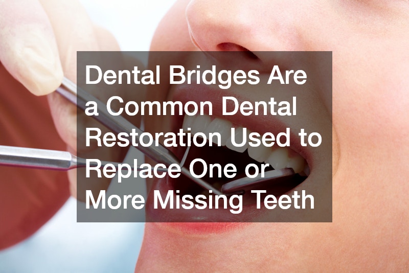 Dental Bridges Are a Common Dental Restoration Used to Replace One or More Missing Teeth