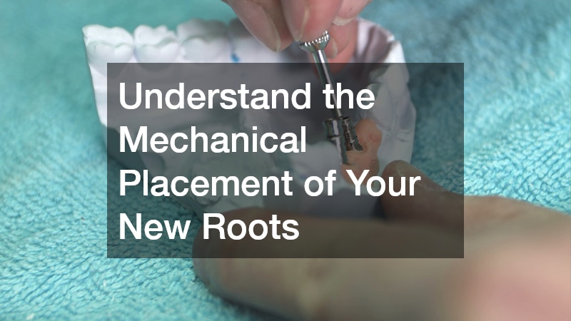 Understand the Mechanical Placement of Your New Roots