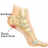plantarfasciitic