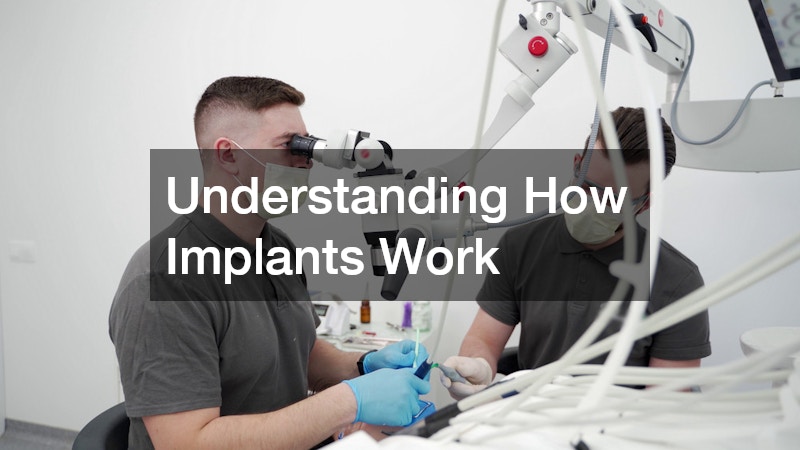 Understanding How Implants Work