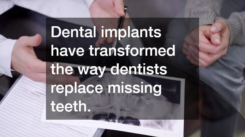 Dental implants have transformed the way dentists replace missing teeth.