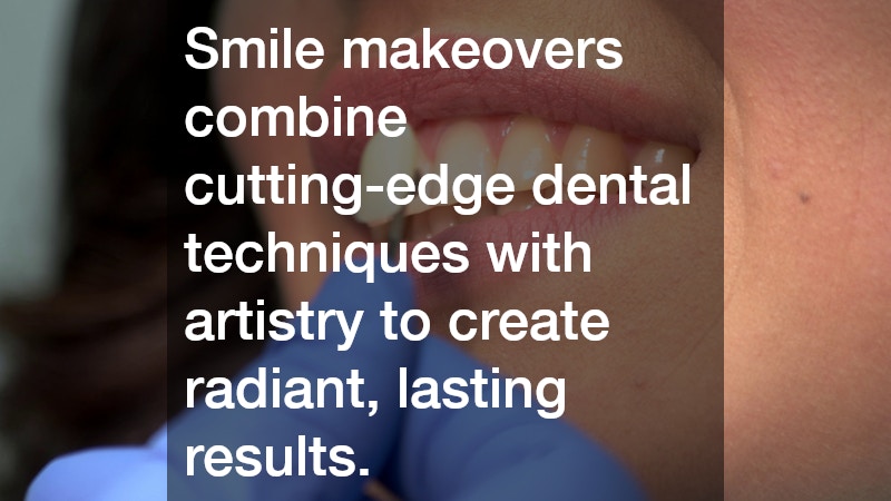 Smile makeovers combine cutting-edge dental techniques with artistry to create radiant, lasting results.