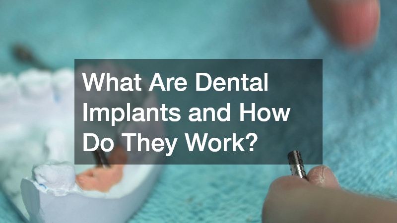 What Are Dental Implants and How Do They Work?
