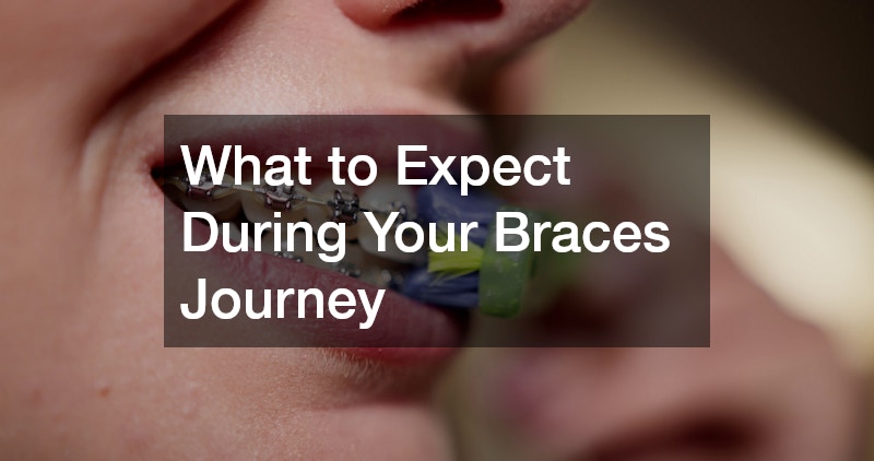 What to Expect During Your Braces Journey