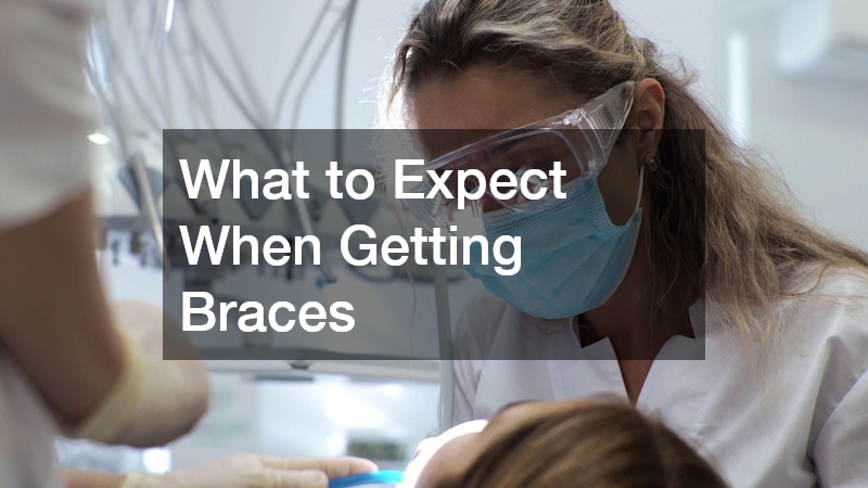 What to Expect When Getting Braces