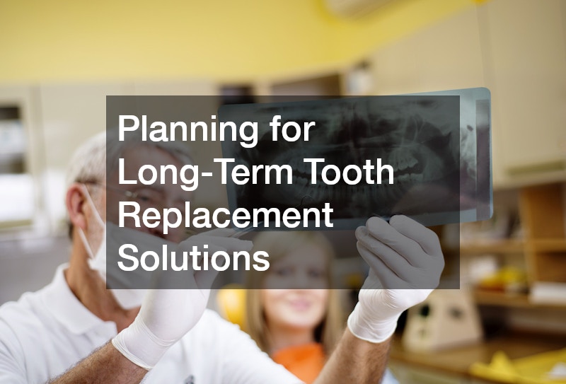 Planning for Long-Term Tooth Replacement Solutions