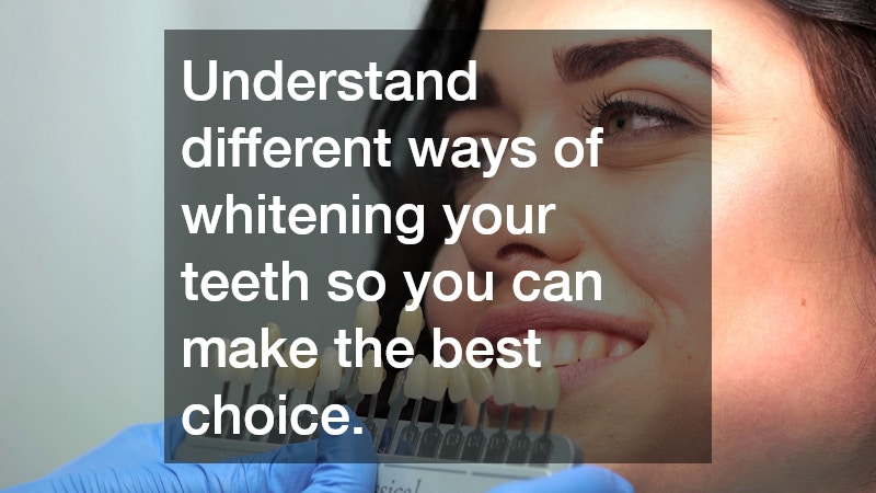 Understand different ways of whitening your teeth so you can make the best choice.