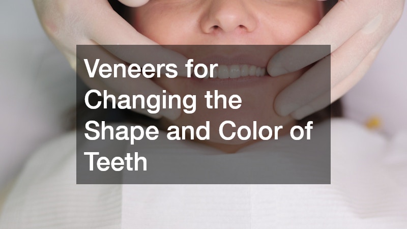Veneers for Changing the Shape and Color of Teeth
