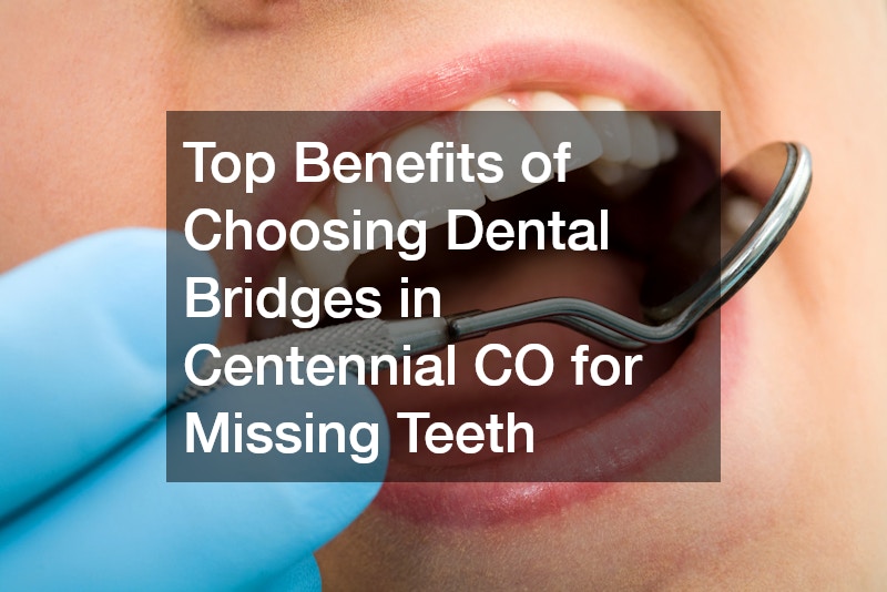 Top Benefits of Choosing Dental Bridges in Centennial CO for Missing Teeth