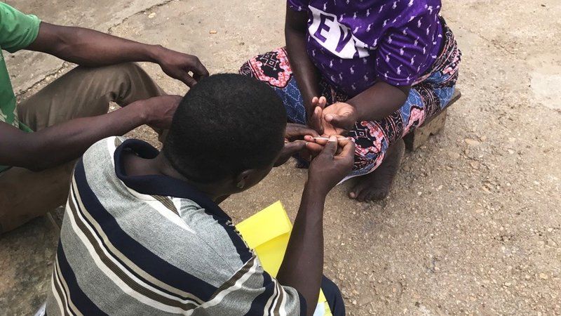 Malaria Test
